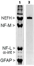 MAB2320 - Neurofilament H (200 kD)