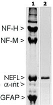 MAB2321 - Neurofilament L (68kDa)
