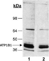 MAB2323 - ATP1B1