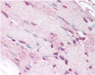 MAB2329 - Defensin alpha 5