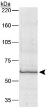 MAB2330 - Bestrophin-1