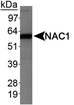 MAB2333 - NACC1 / BTBD14B