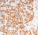 MAB2333 - NACC1 / BTBD14B