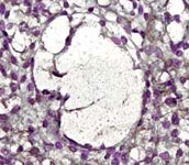 MAB2335 - MMP-2