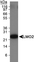MAB2336 - Rhombotin-2