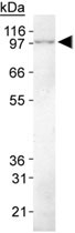 MAB2337 - CIP2A