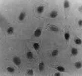 MAB2354 - CAF-1 subunit B