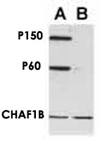 MAB2355 - CAF-1 subunit B