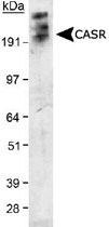 MAB2357 - CaSR