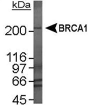 MAB2362 - BRCA1 / RNF53