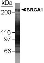 MAB2363 - BRCA1 / RNF53