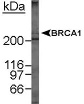 MAB2364 - BRCA1 / RNF53