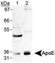 MAB2371 - Apolipoprotein E / Apo E