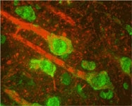 MAB2373 - Beta-ARK-1 / ADRBK1