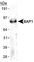 MAB2377 - BAP1