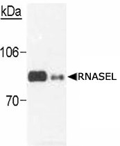 MAB2378 - RNASEL