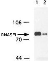MAB2378 - RNASEL