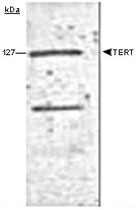 MAB2379 - TERT