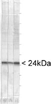 MAB2381 - UCHL1 / PGP9.5