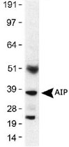 MAB2382 - AIP / XAP2