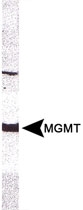 MAB2383 - MGMT