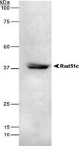 MAB2387 - RAD51C
