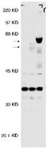 MAB2390 - PPP2CA