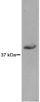 MAB2395 - RAD51L3