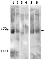 MAB2398 - FANCD2