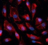 MAB2408 - Caveolin-1