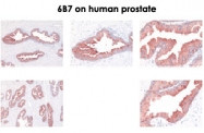 MAB2487 - KLK2 / Kallikrein-2