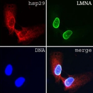 MAB2500 - Lamin-A/C (LMNA)