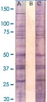 MAB2545 - Phosphoserine