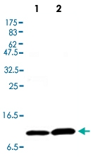 MAB2682 - Hemoglobin