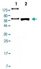 MAB2685 - Alpha-fetoprotein / AFP