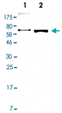 MAB2686 - Alpha-fetoprotein / AFP