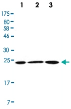 MAB2687 - DJ-1 / PARK7