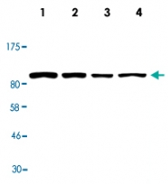 MAB2688 - Acetylcholinesterase