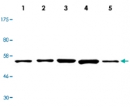 MAB2692 - RIPK2