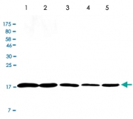 MAB2699 - Cofilin-1