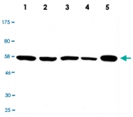 MAB2701 - SMAD3