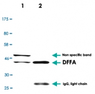 MAB2703 - DFFA / ICAD