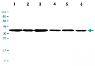 MAB2707 - Aurora kinase B
