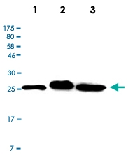 MAB2709 - Calbindin