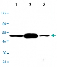 MAB2711 - TP53 / p53