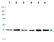MAB2712 - UCHL3