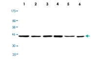 MAB2713 - Casein kinase I epsilon
