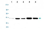 MAB2715 - GSK3 beta