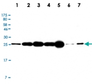 MAB2717 - UCHL1 / PGP9.5