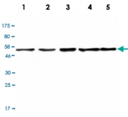 MAB2719 - CHK1